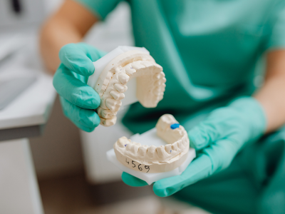 photo of dentist holding teeth model